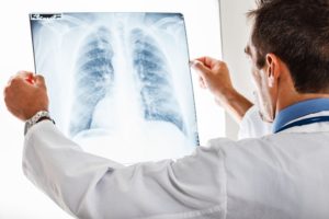 Misread X-Rays Lawyers